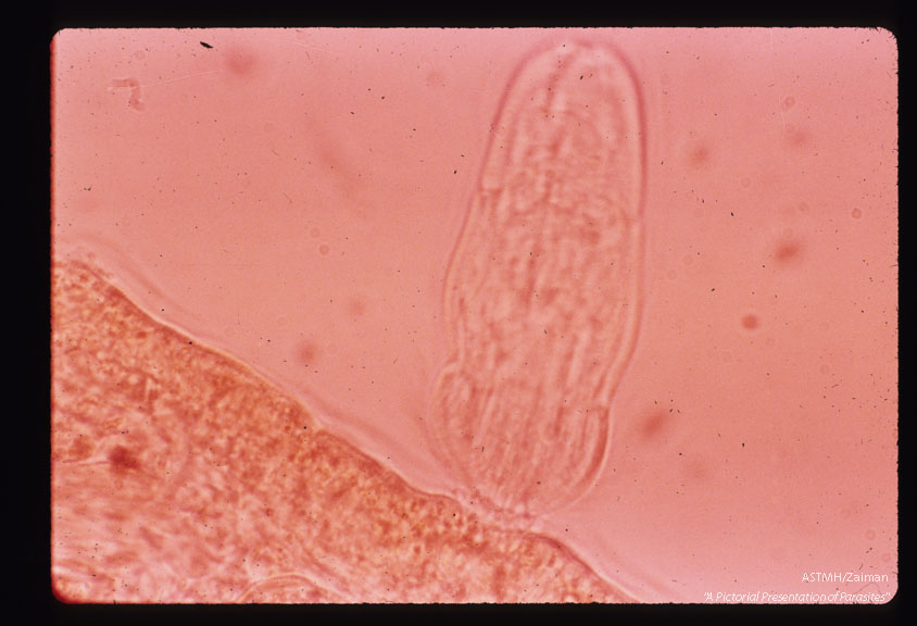 Miracidium penetrating the snail host. TnHnplanni-hia gYiiat-na4 Early stage of penetration.