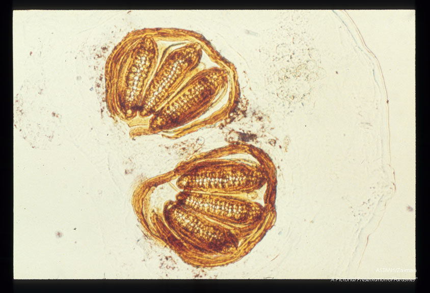 Maggot posterior spiracle.