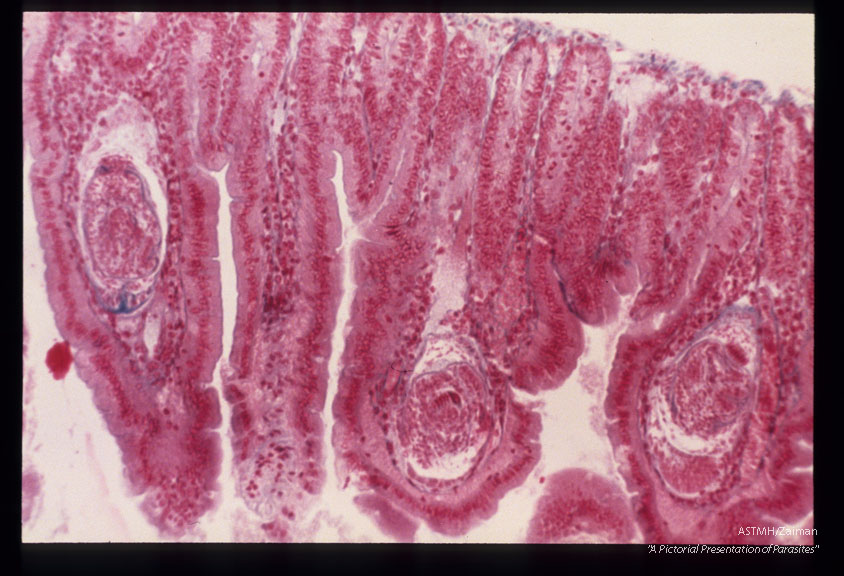 Cysticercoids in villi of a mouse.