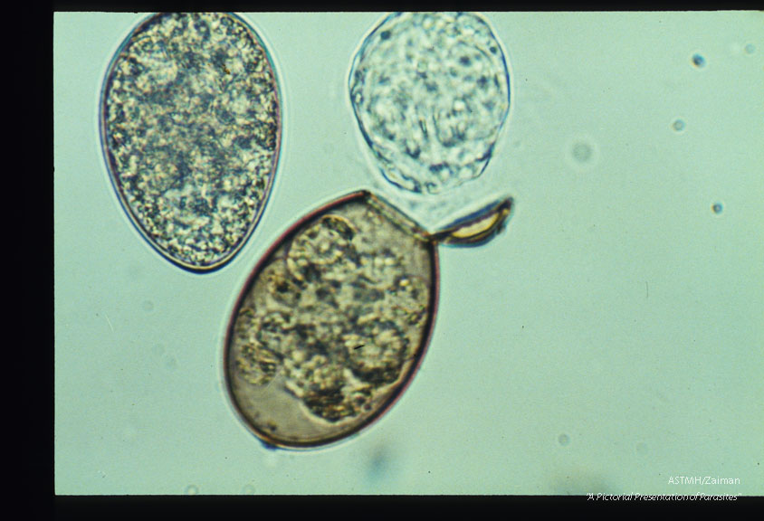 Coracidium hatching from an egg.