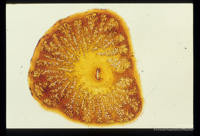 Maggot posterior spiracle.