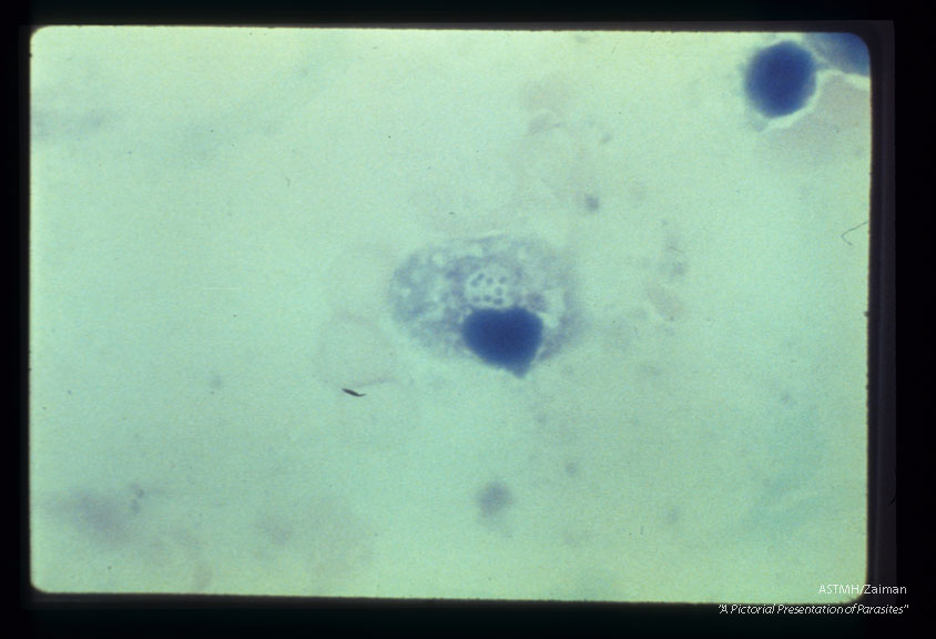 This slide shows eight parasites in a single cell from a lung touch preparation demonstrating the intracellular character of the parasite.
