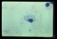 This slide shows eight parasites in a single cell from a lung touch preparation demonstrating the intracellular character of the parasite.