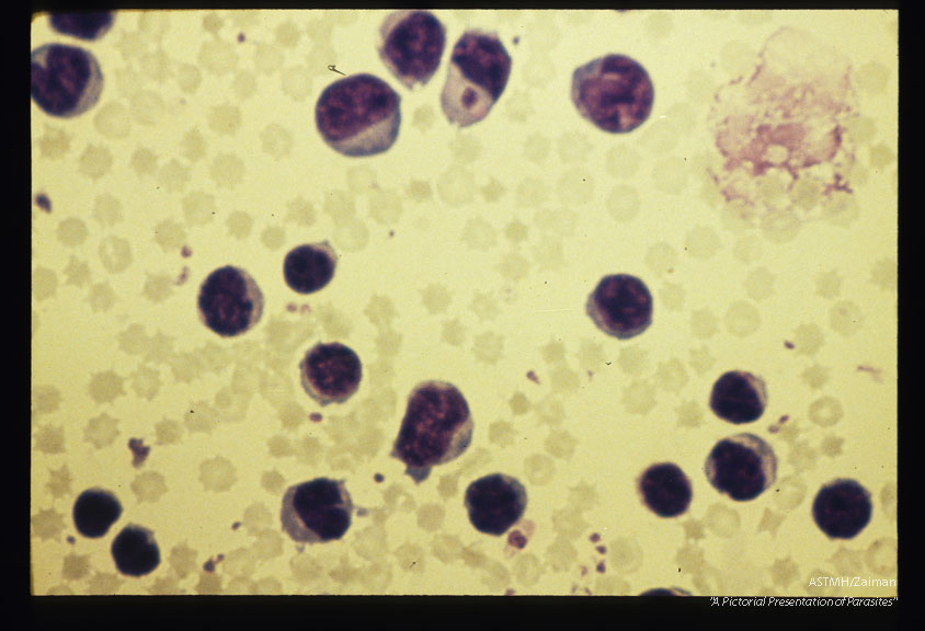 Merozoite in leukocyte in bovine blood smear.