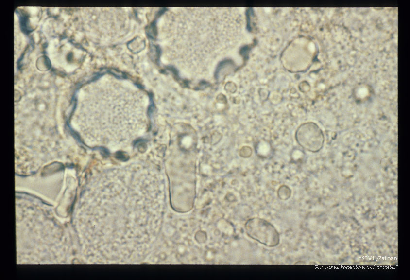 "Star" cysts from blood agar plate culture made from human cornea.