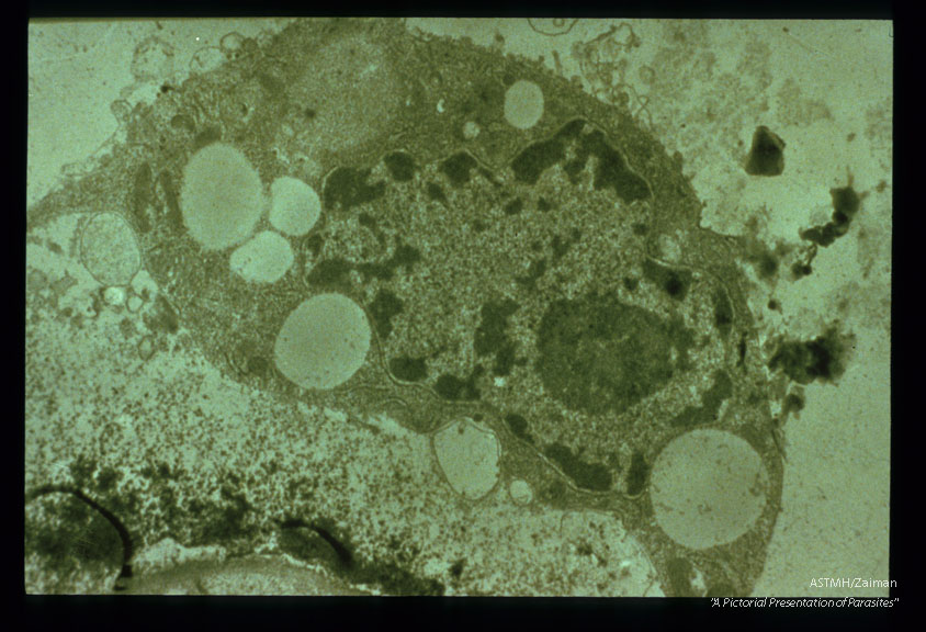 Transmission electron micrograph of a hemocyte during an encapsulation reaction against a microfilaria in A. trivittatus. Note the mf in the lower left corner with melanin deposits on the cuticle.