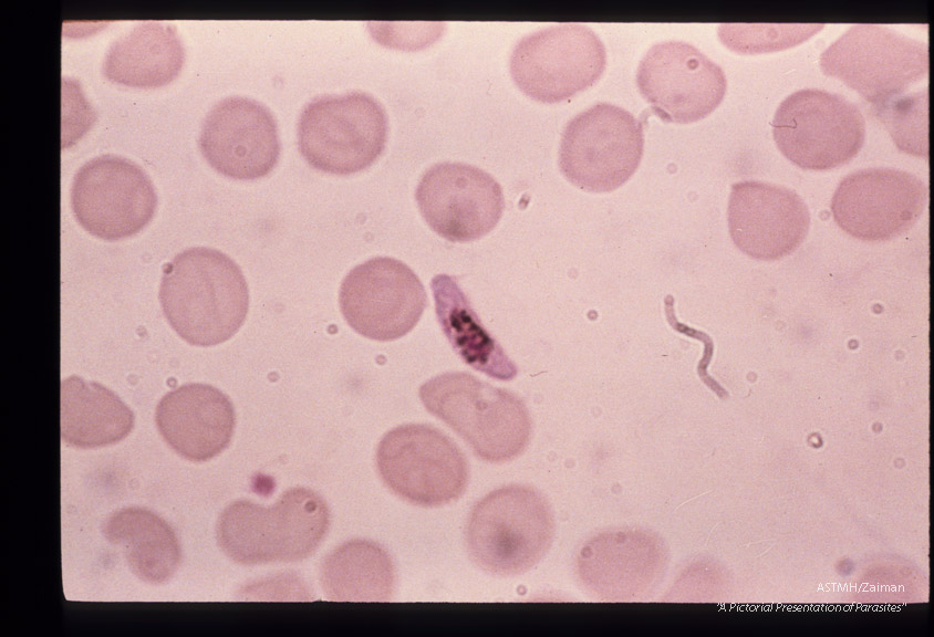 The development of male sexual cells from gametocyte to sperm cells (exflagellation) is shown in this series.