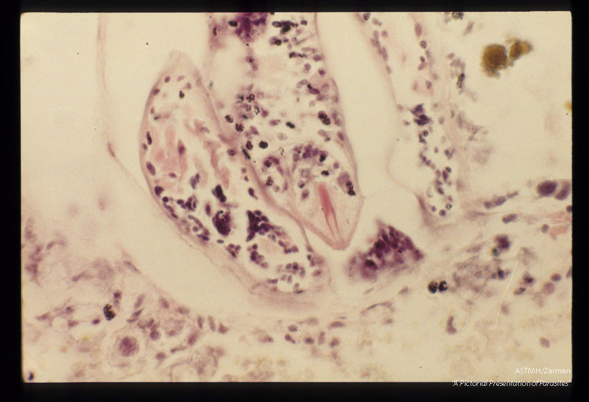 Cercaria in Brotia showing the stylet.