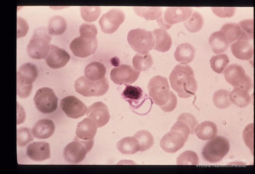 The development of male sexual cells from gametocyte to sperm cells (exflagellation) is shown in this series.