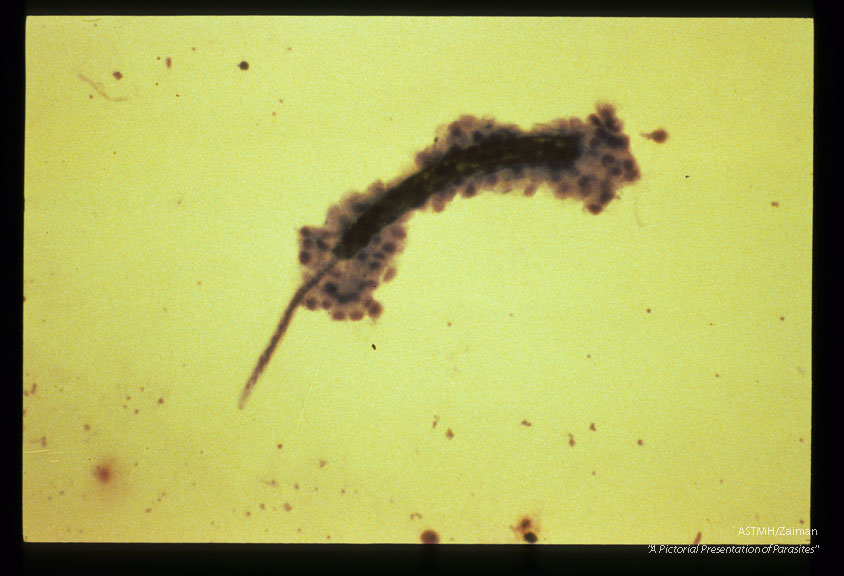 Microfilaria removed from the hemocoel of A. aegypti at 3 days following intrathoracic inoculation. Note the deposition of protein-polyphenol complexes around a portion of the parasite and the numerous hemocytes forming the encapsulation reaction.
