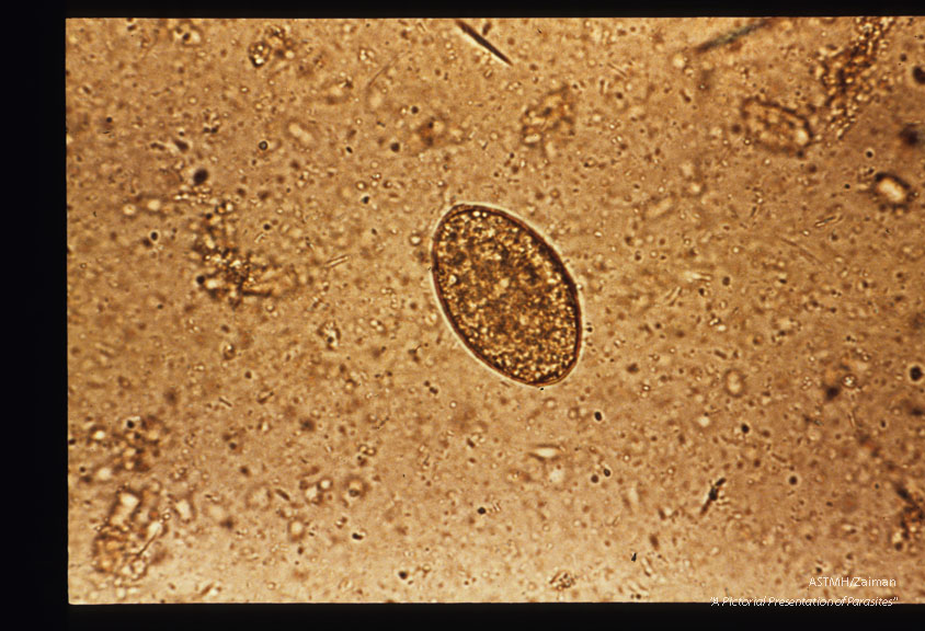 Egg in stool. Iodine stained.