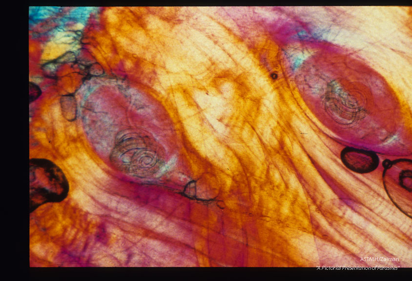 Encysted muscle larvae in a boar from the same farm.