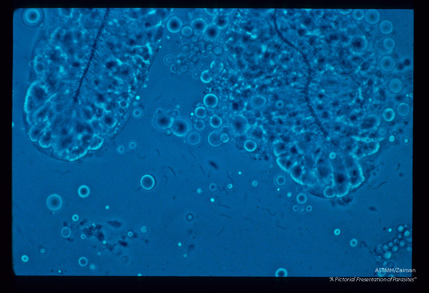 Sporozoites near the dissected salivary glands of Culex pipiens pipiens.