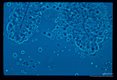Sporozoites near the dissected salivary glands of Culex pipiens pipiens.