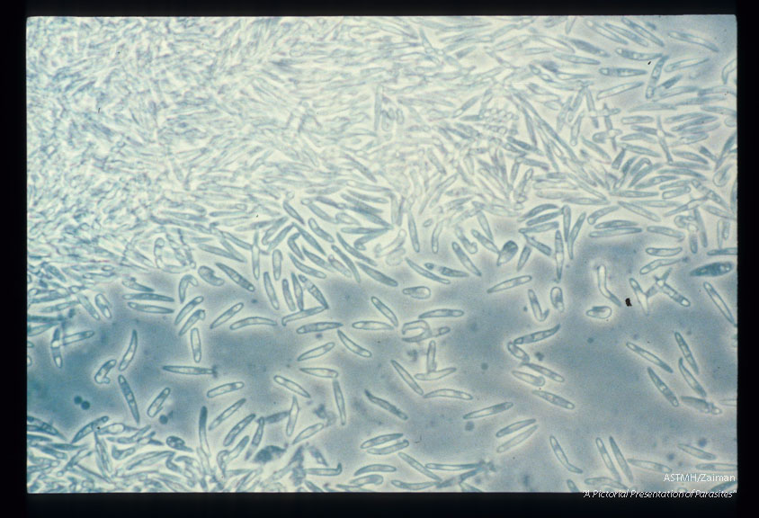 Zoites from the muscle of a duck (stained. 1316 and biphase microscopy, 1317).