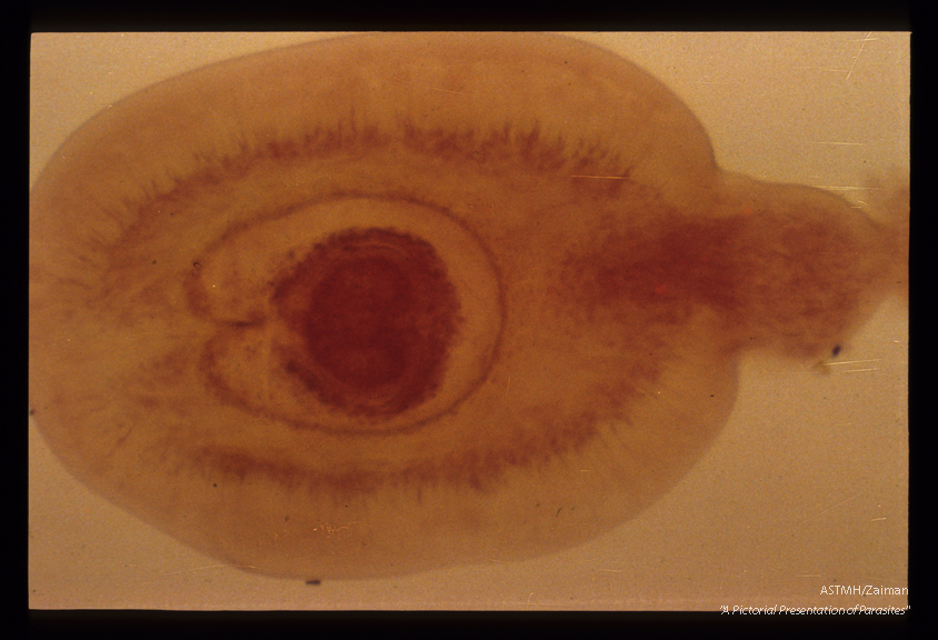 Cysticercoid larvae, from an insect intermediate host.
