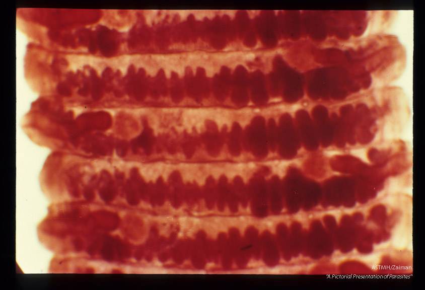 Segments from human case.