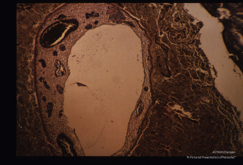 Sections through adalts in Rattus norvegicus lung.