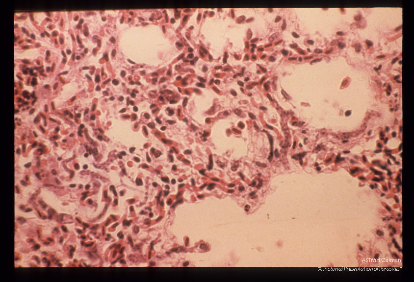 Schizonts in budgerigar lung section. 9 days PI. H & E.