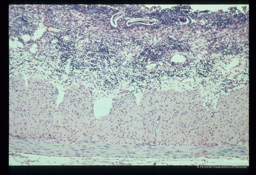 Duodenal ulcer induced by experimental infection of Erythrocebus patas.