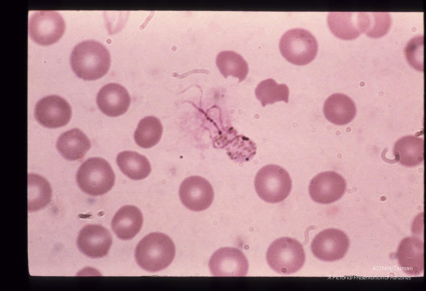 The development of male sexual cells from gametocyte to sperm cells (exflagellation) is shown in this series.