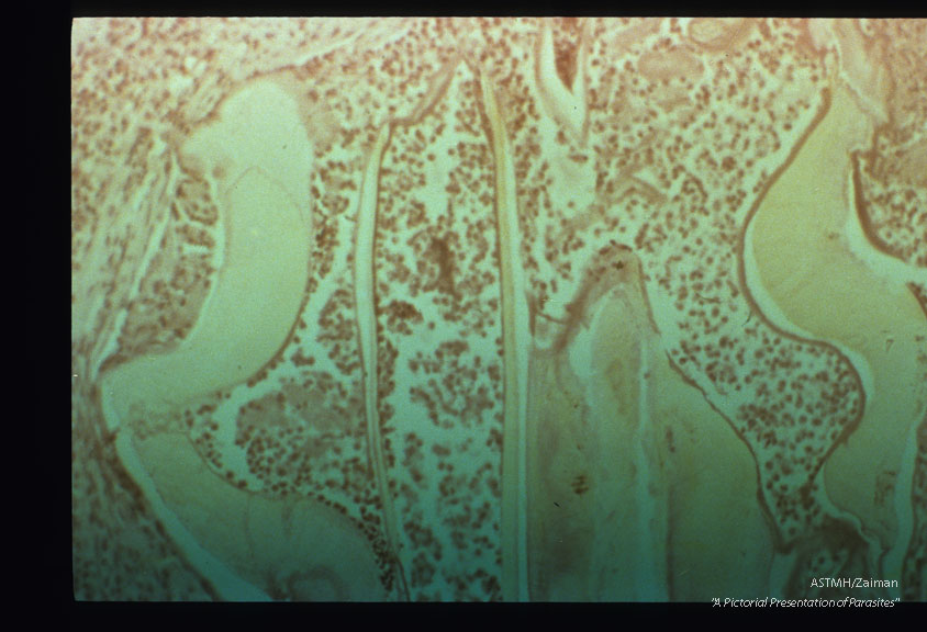 Mouth parts in skin.