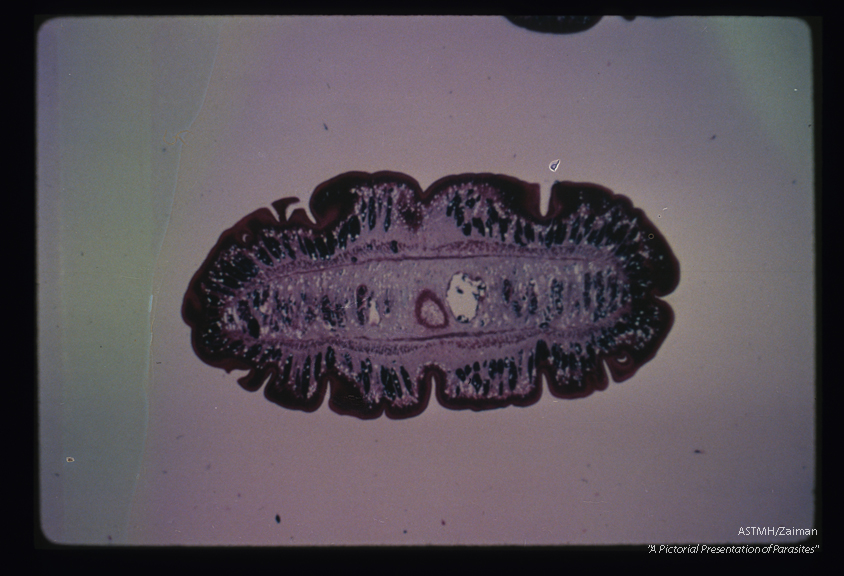 Cross section through a gravid proglottid.