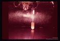 Lee case of primary amoebic meningoencephalitis. Spinal fluid.