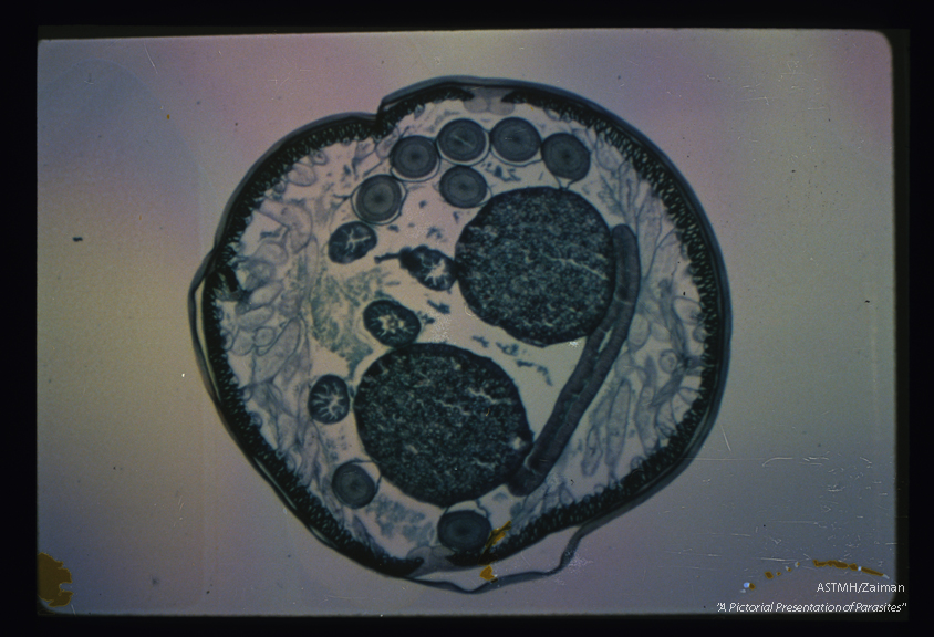 Cross section of an adult female. The outer cuticle is partially detached from the parasite at 12 o'clock. Below it, one can see the hypodermis and musculature. Lateral lines are visible at 12 and 6 o'clock. Central to the musculature, the flattened tube is gut, the round tubes are reproductive structures. The large round tubes are egg-containing uteri, the others are sections through ovaries and oviducts.