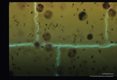 Thick smear, field stain.