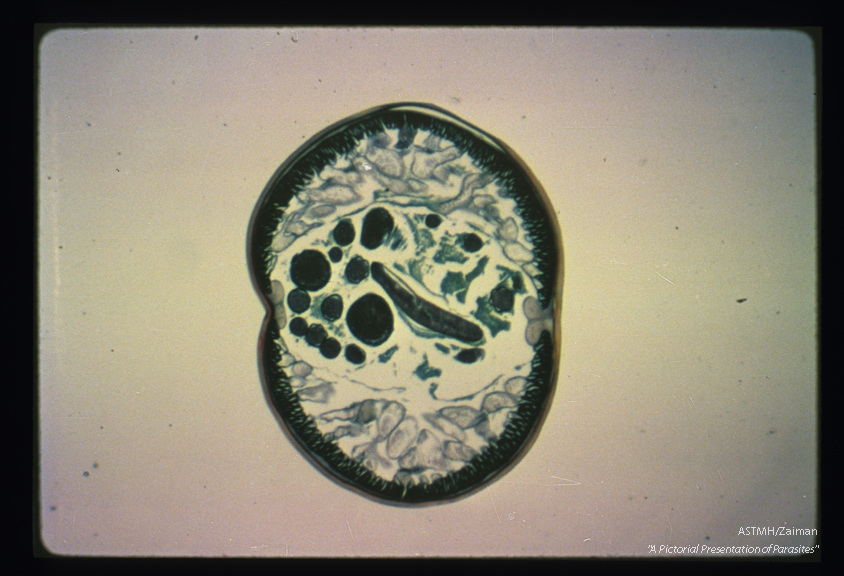 Cross section of an adult male. The male is smaller in cross section. The round ducts are male reproductive structures.