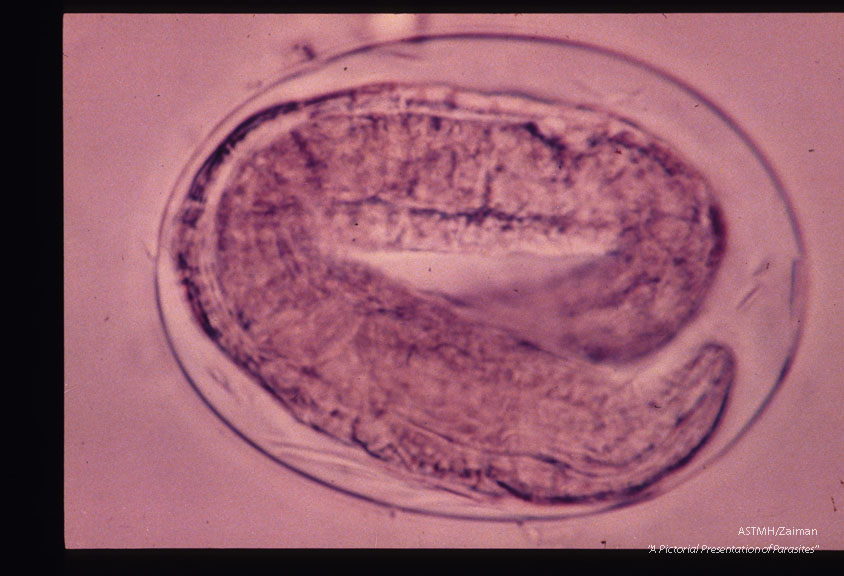 Egg showing larva.