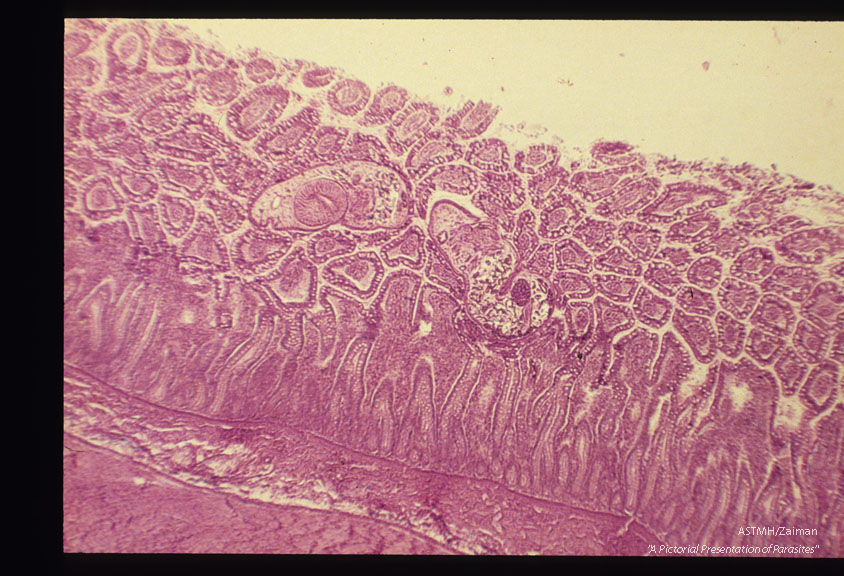 Adult in intestinal wall.