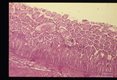 Adult in intestinal wall.