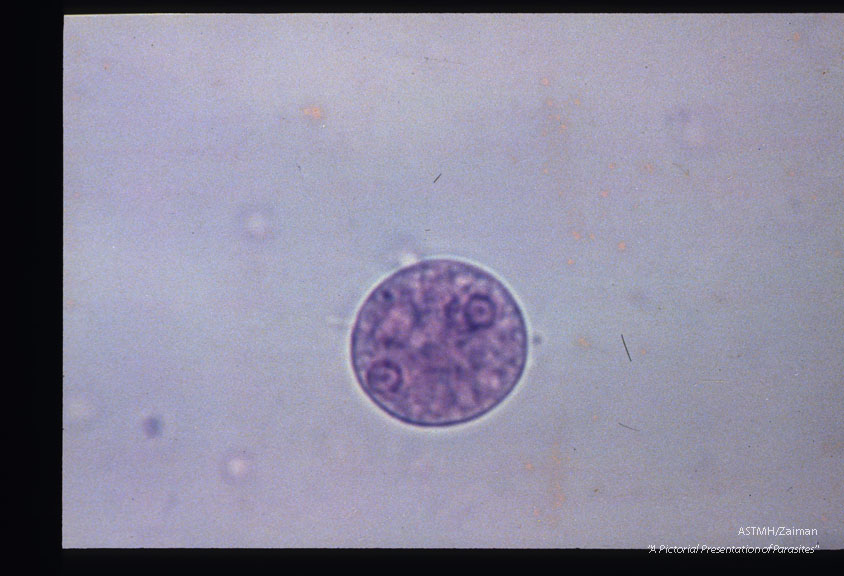 Mature cysi. MIF stain.