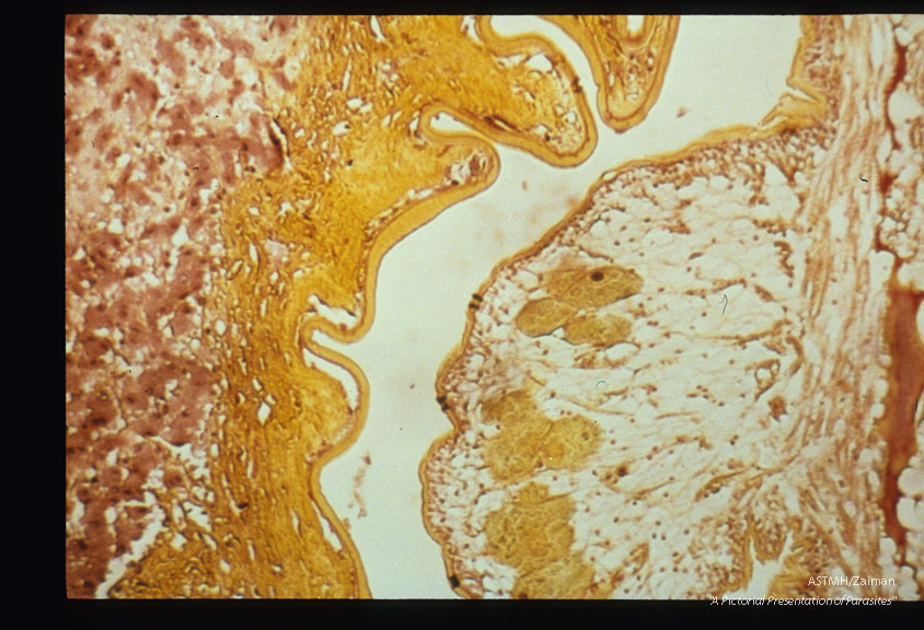 Liver sections at different magnifi­cations.