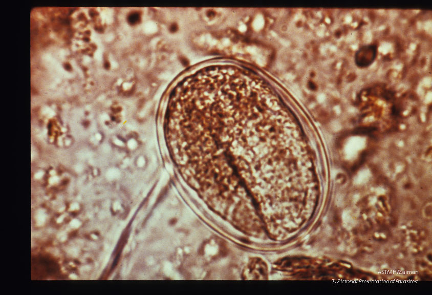 Formed larva in egg.