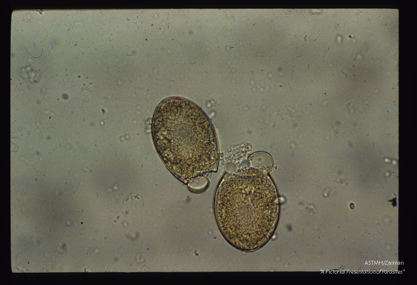 Two eggs in stool with operculi opened.