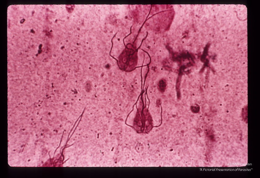 Protargol stained trophozoites in stool.