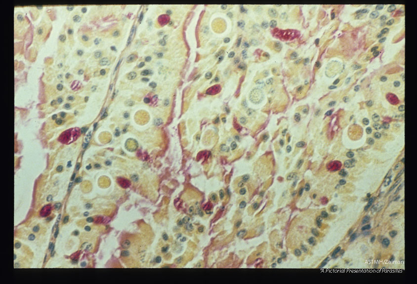Canine intestine with gametes and oocyst.