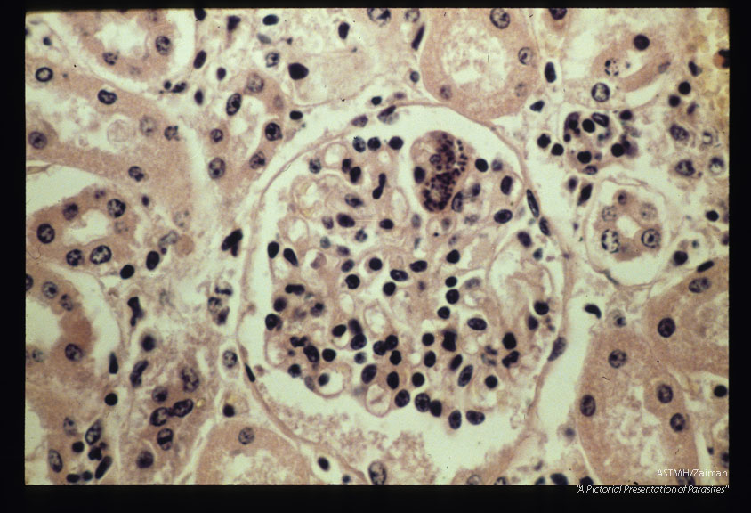 ( = Sarcocystis cruzi, = Sarcocystis fusiformis). Schizont in endothelium of bovine kidney glomerulus.
