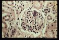 ( = Sarcocystis cruzi, = Sarcocystis fusiformis). Schizont in endothelium of bovine kidney glomerulus.