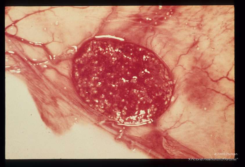 Normal fetal cotyledon.