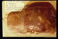 Calf liver damaged by migrating larvae.