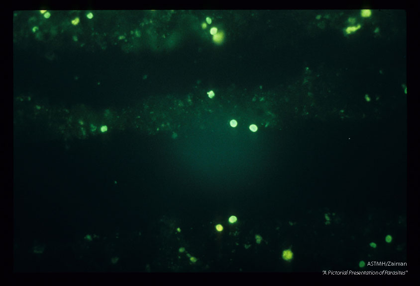 Immunofluorescent monoclonal antibody stain.