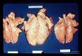 Mouse lungs showing the cumulative effect of concomitant infection with ascarids and a pneumonic virus. The laterally placed lungs have been subjected to either Ascaris or virus; the central lung suffered both infections.