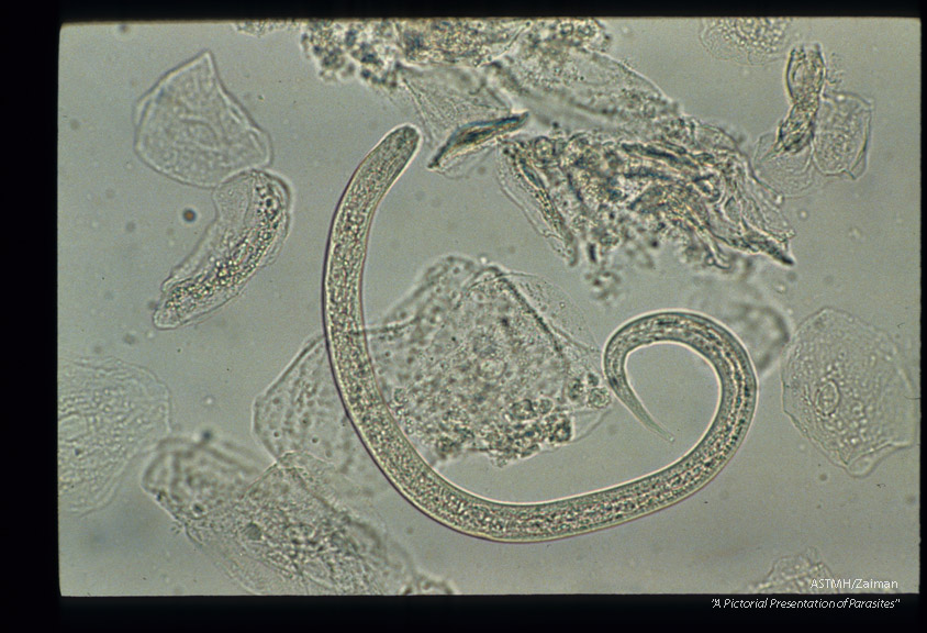 Filariform larva with forked tail.