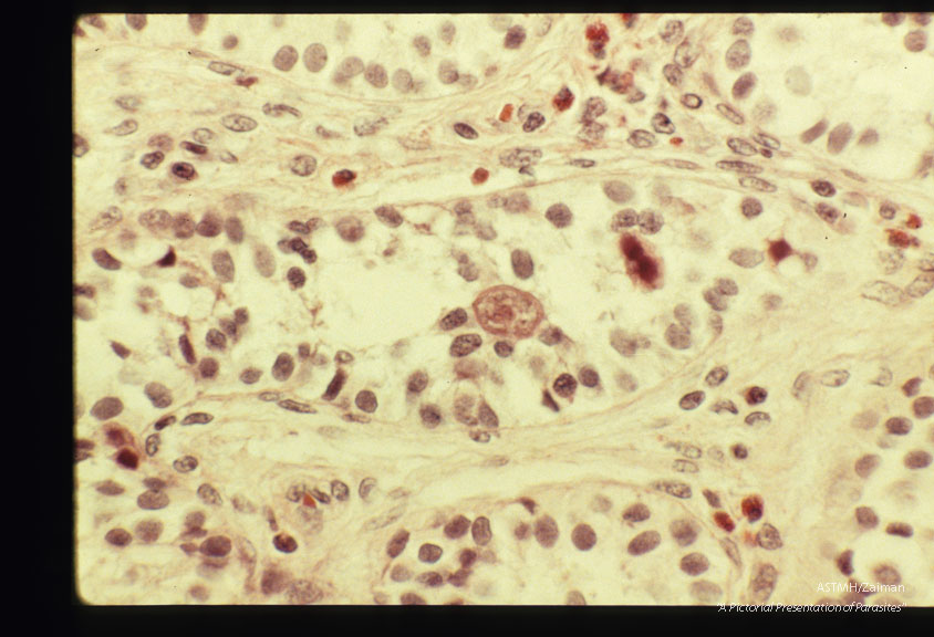 Migrating larva is present in a seminiferous tubule.