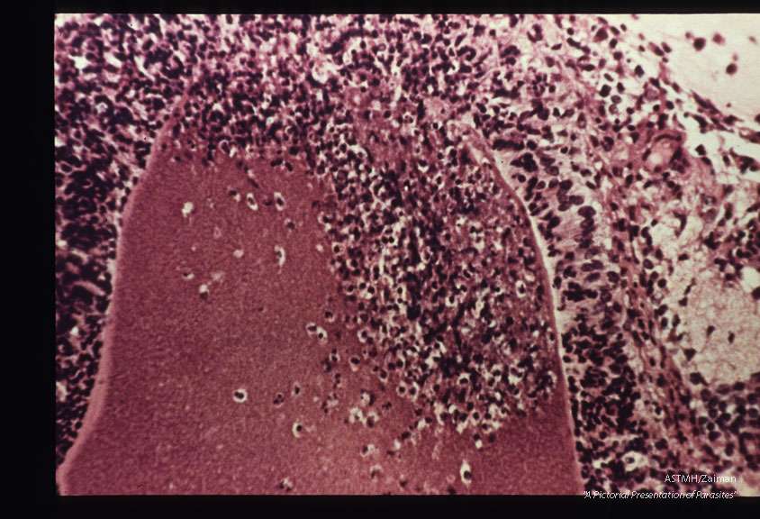 Cyst rupture and retinochoroiditis in hamster. H&E stain.