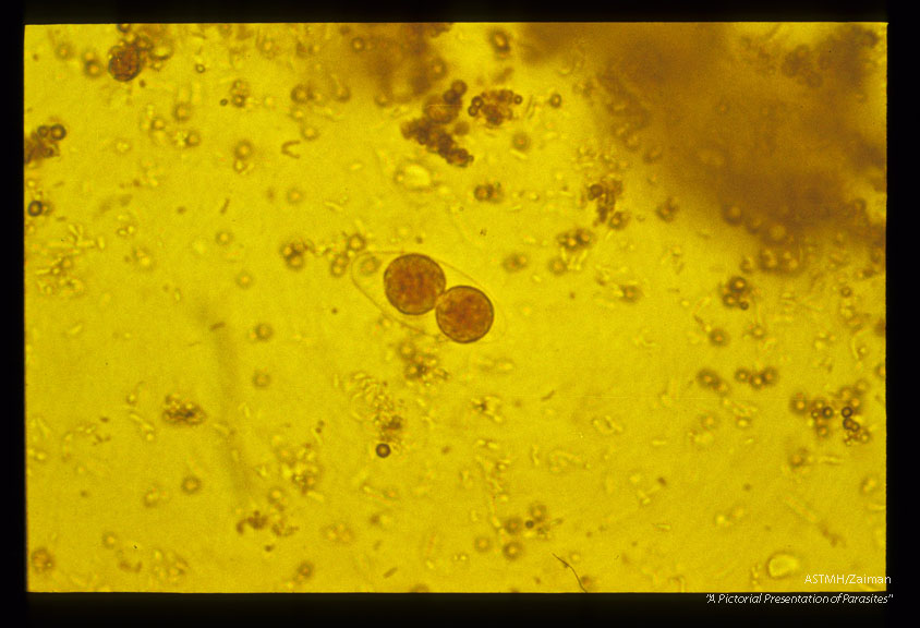 Oocysts, iodine stained and unstained in stool